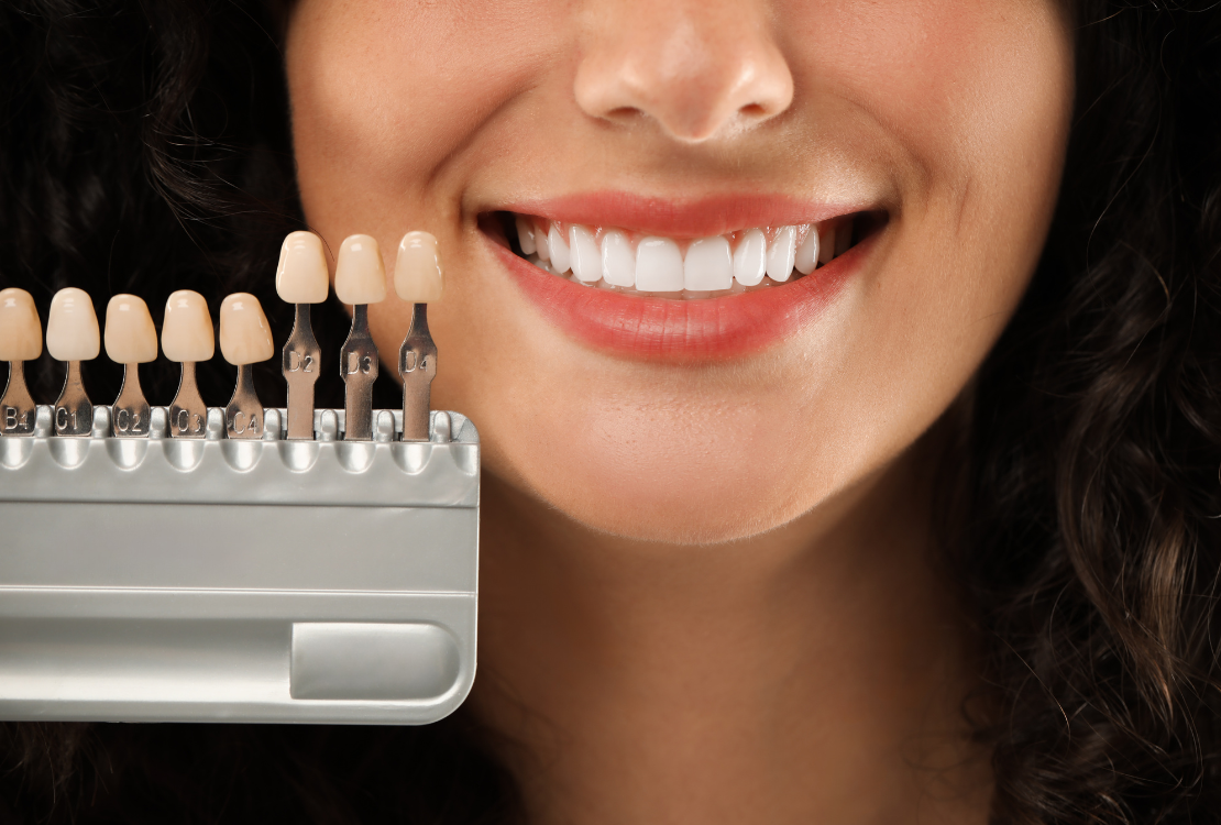 Estetica Dentale